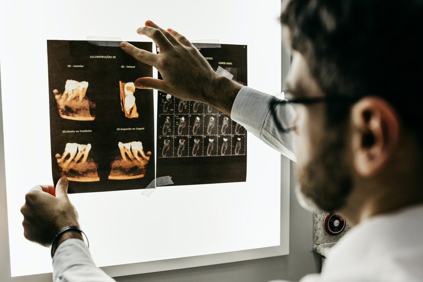 do students get free dental care - dentist with tooth xray